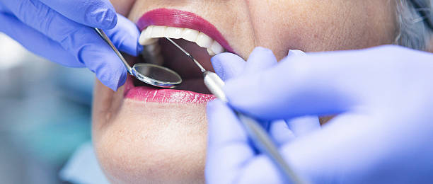 Best Broken or Cracked Tooth Emergency Dentist in West Little River, FL